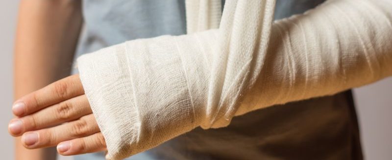 Mơ Bị Gãy Tay Điềm Báo Gì Và Những Con Số Liên Quan Mới Nhất 2025 3 Mộng bản thân té xe gãy tay đánh ngay 12 và 73